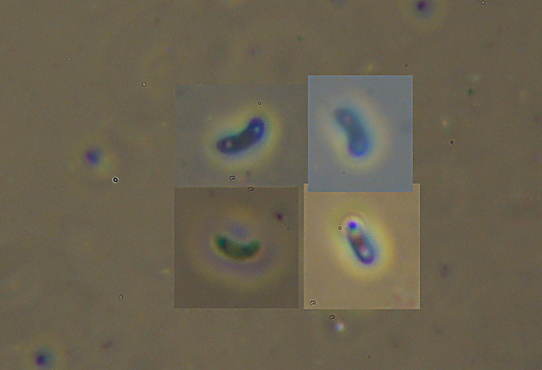 Sono sicuro che siete tutti d''accordo (Skeletocutis amorpha)